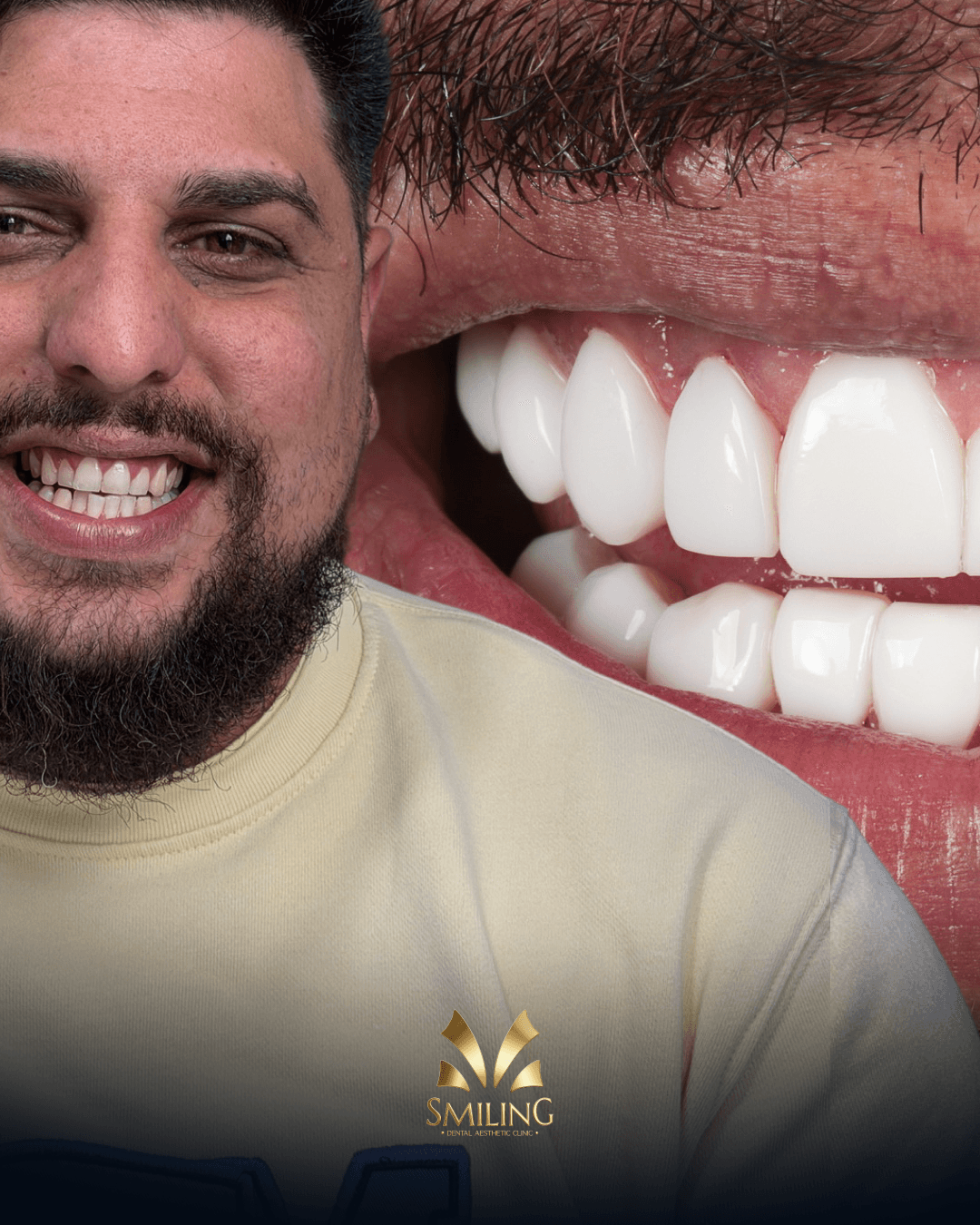 Retrato de una paciente de Smiling Clinics