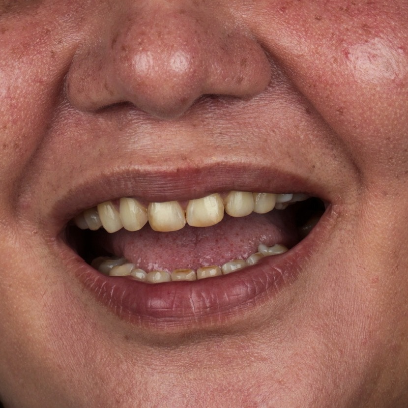La sonrisa de Angélica · Antes del tratamiento