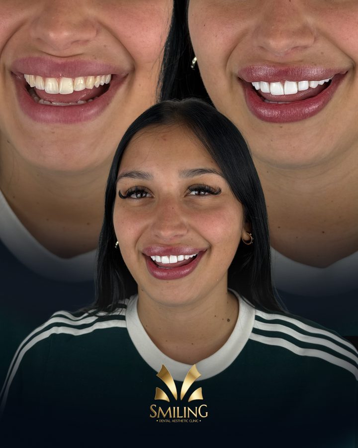 Paciente de Smiling con su nueva sonrisa