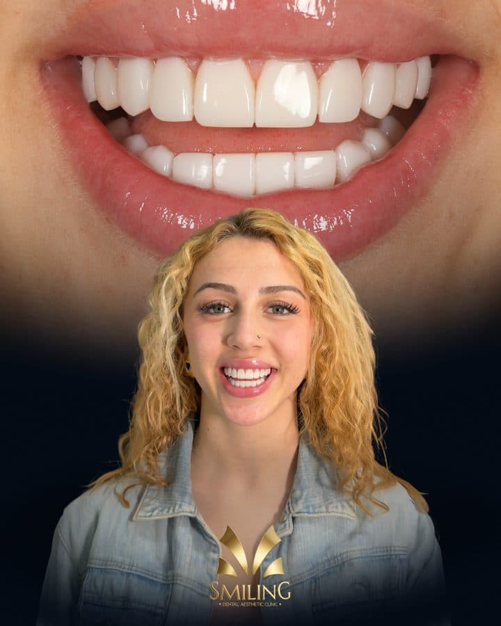 Retrato de una paciente de Smiling Clinics