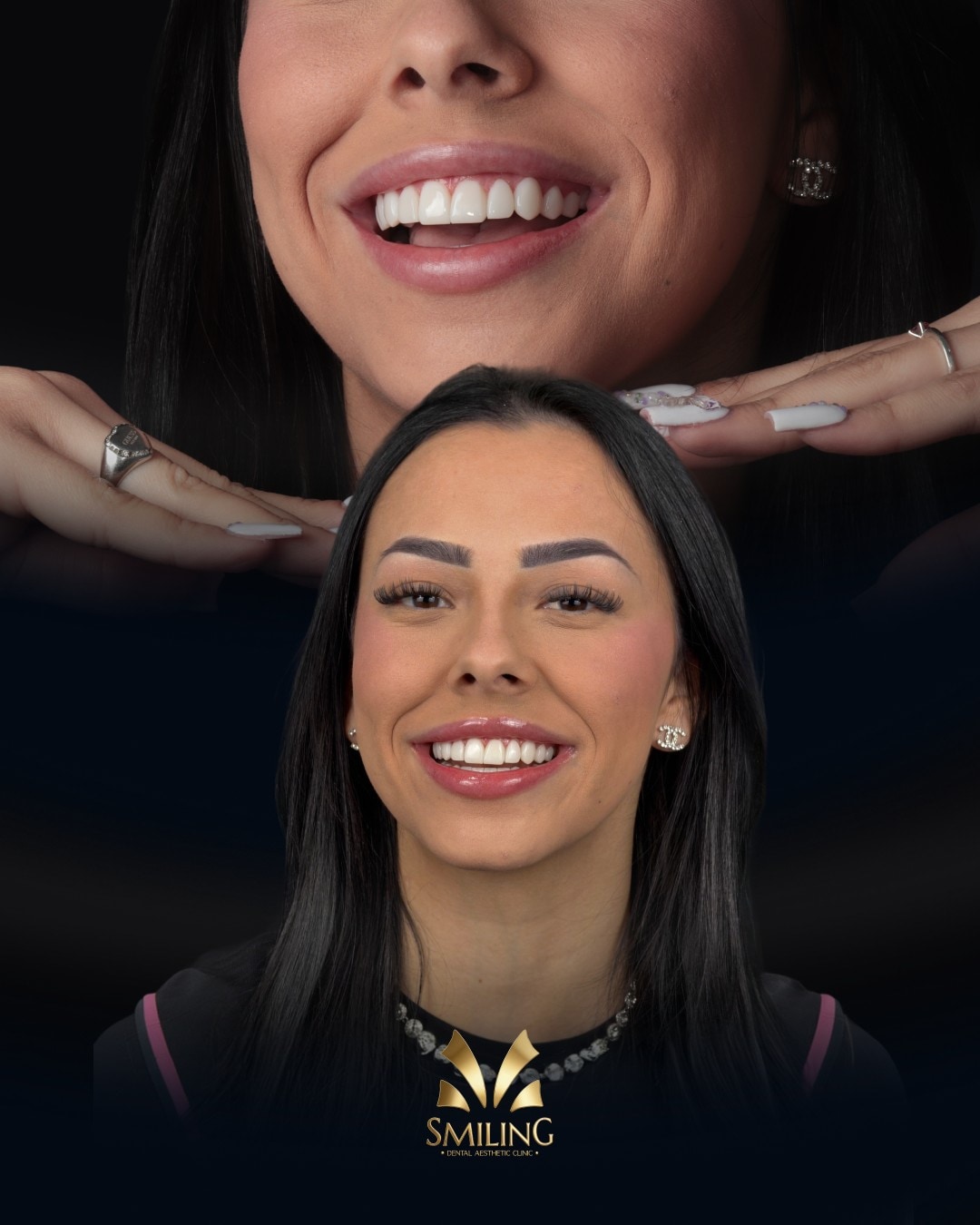 Paciente de Smiling con su nueva sonrisa