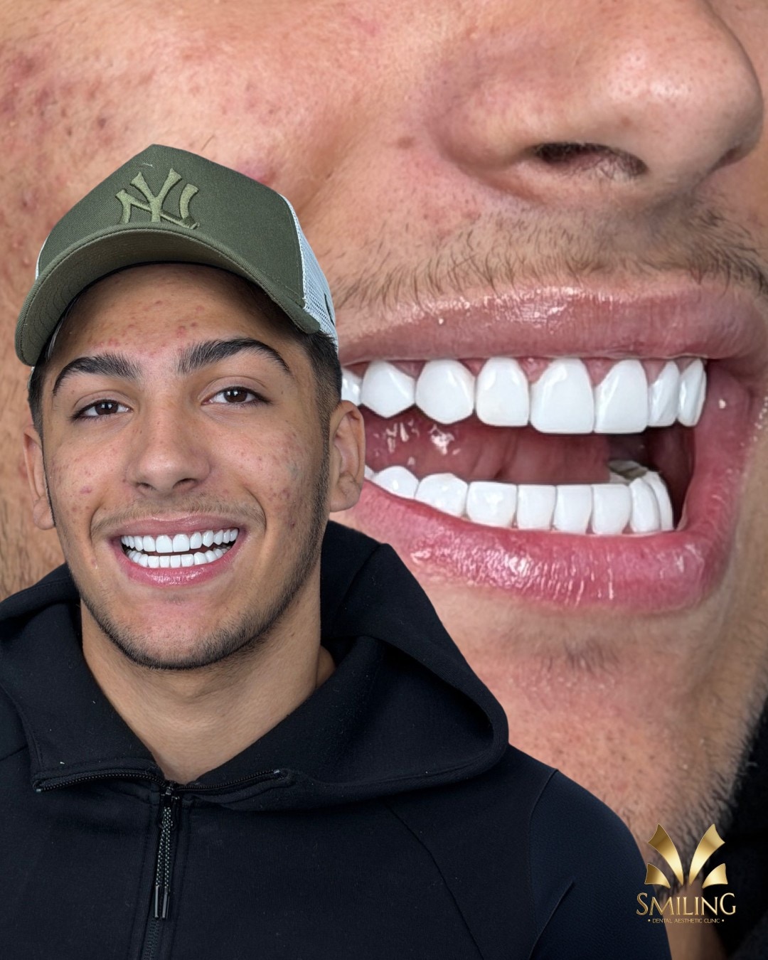 Paciente de Smiling con su nueva sonrisa