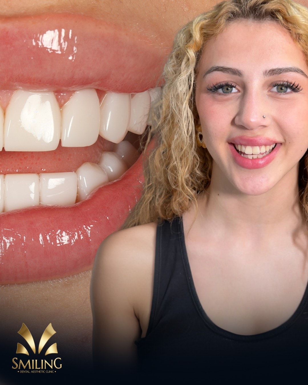 Paciente de Smiling con su nueva sonrisa