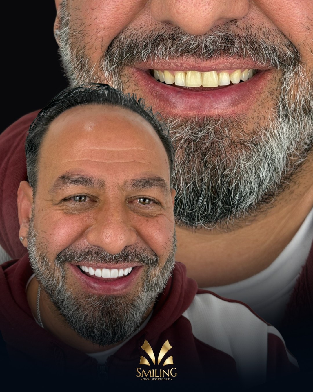 Paciente de Smiling con su nueva sonrisa