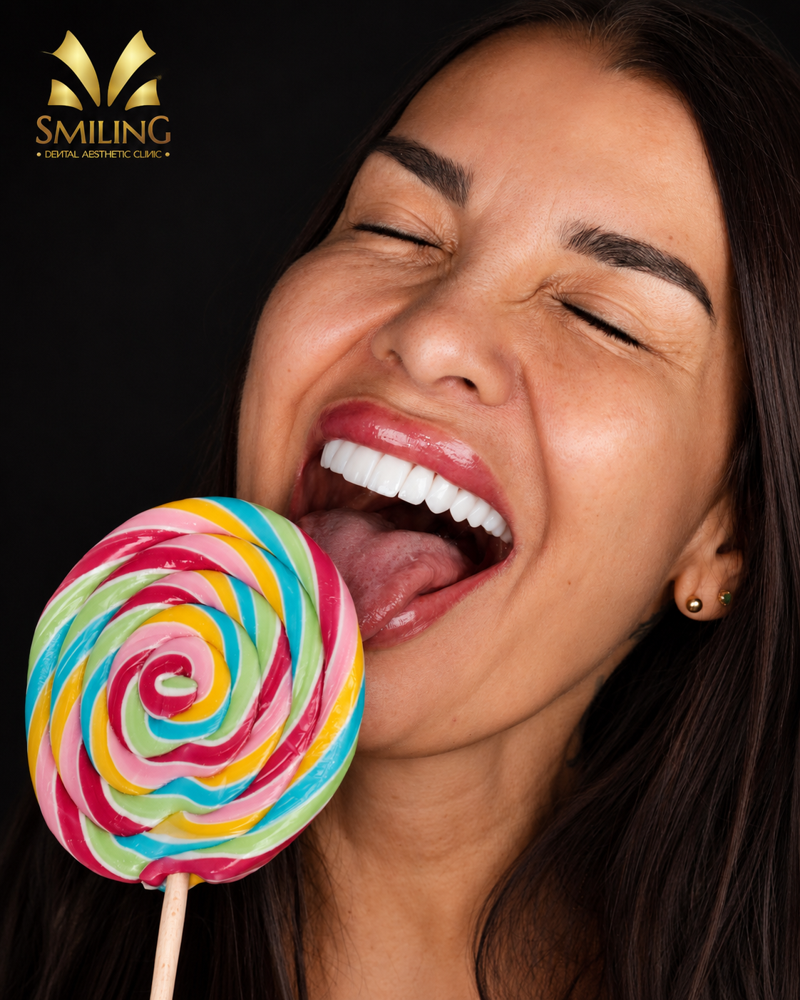 Sonrisa diseñada en Smiling · carillas de alta estética y alto realismo dental
